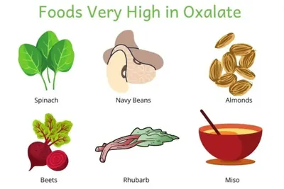 Illustrated foods very high in oxalate: spinach, navy beans, almonds, beets, rhubarb and miso